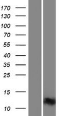 Western Blot: INTS6 Overexpression Lysate (Adult Normal) [NBP2-08537] Left-Empty vector transfected control cell lysate (HEK293 cell lysate); Right -Over-expression Lysate for INTS6.