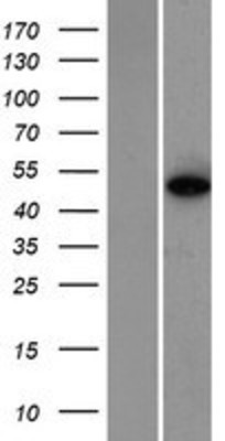 Western Blot: ZNF384 Overexpression Lysate (Adult Normal) [NBP2-08536] Left-Empty vector transfected control cell lysate (HEK293 cell lysate); Right -Over-expression Lysate for ZNF384.