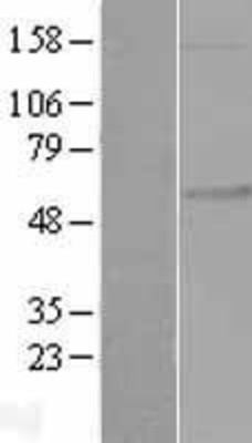 Western Blot: FKRP Overexpression Lysate (Adult Normal) [NBP2-08534] Left-Empty vector transfected control cell lysate (HEK293 cell lysate); Right -Over-expression Lysate for FKRP.