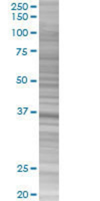 MPPED1 transfected lysate.