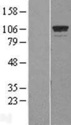 Western Blot: GTF3C2 Overexpression Lysate (Adult Normal) [NBP2-08586] Left-Empty vector transfected control cell lysate (HEK293 cell lysate); Right -Over-expression Lysate for GTF3C2.