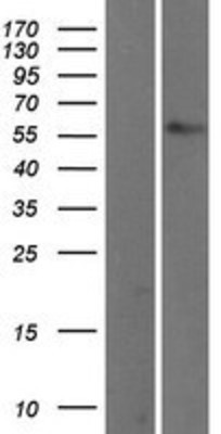 Western Blot: TBX5 Overexpression Lysate (Adult Normal) [NBP2-09068] Left-Empty vector transfected control cell lysate (HEK293 cell lysate); Right -Over-expression Lysate for TBX5.