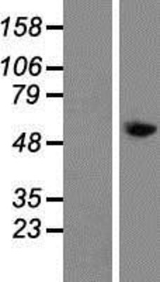 Western Blot: TAT Overexpression Lysate (Adult Normal) [NBP2-09032] Left-Empty vector transfected control cell lysate (HEK293 cell lysate); Right -Over-expression Lysate for TAT.