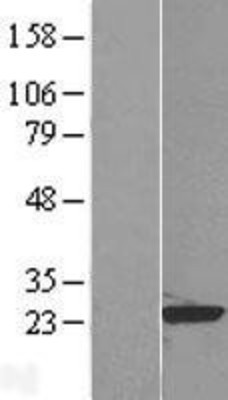 Western Blot: RAP1B Overexpression Lysate (Adult Normal) [NBP2-09134] Left-Empty vector transfected control cell lysate (HEK293 cell lysate); Right -Over-expression Lysate for RAP1B.