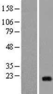 Western Blot: NCALD Overexpression Lysate (Adult Normal) [NBP2-09219] Left-Empty vector transfected control cell lysate (HEK293 cell lysate); Right -Over-expression Lysate for NCALD.