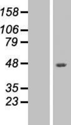 Western Blot: VEGFA Overexpression Lysate (Adult Normal) [NBP2-09190] Left-Empty vector transfected control cell lysate (HEK293 cell lysate); Right -Over-expression Lysate for VEGFA.