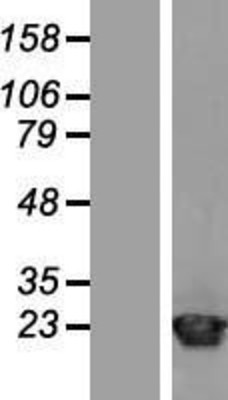 Western Blot: ARF1 Overexpression Lysate (Adult Normal) [NBP2-09169] Left-Empty vector transfected control cell lysate (HEK293 cell lysate); Right -Over-expression Lysate for ARF1.