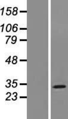 Western Blot: MOSPD3 Overexpression Lysate (Adult Normal) [NBP2-09210] Left-Empty vector transfected control cell lysate (HEK293 cell lysate); Right -Over-expression Lysate for MOSPD3.