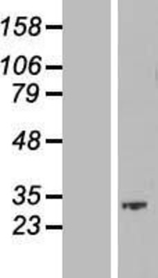 Western Blot: SKA1 Overexpression Lysate (Adult Normal) [NBP2-09204] Left-Empty vector transfected control cell lysate (HEK293 cell lysate); Right -Over-expression Lysate for SKA1.