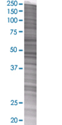 CYP2R1 transfected lysate.