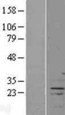 Western Blot: FAM166A Overexpression Lysate (Adult Normal) [NBP2-08951] Left-Empty vector transfected control cell lysate (HEK293 cell lysate); Right -Over-expression Lysate for FAM166A.