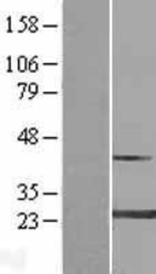 Western Blot: MYL4 Overexpression Lysate (Adult Normal) [NBP2-08944] Left-Empty vector transfected control cell lysate (HEK293 cell lysate); Right -Over-expression Lysate for MYL4.