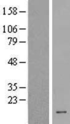 Western Blot: HCFC1R1 Overexpression Lysate (Adult Normal) [NBP2-08973] Left-Empty vector transfected control cell lysate (HEK293 cell lysate); Right -Over-expression Lysate for HCFC1R1.
