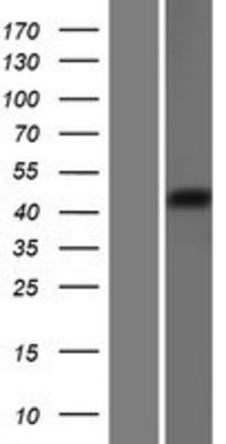 Western Blot: MBOAT4 Overexpression Lysate (Adult Normal) [NBP2-09335] Left-Empty vector transfected control cell lysate (HEK293 cell lysate); Right -Over-expression Lysate for MBOAT4.