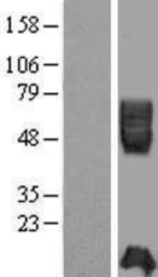 Western Blot: ICAM2 Overexpression Lysate (Adult Normal) [NBP2-09323] Left-Empty vector transfected control cell lysate (HEK293 cell lysate); Right -Over-expression Lysate for ICAM2.