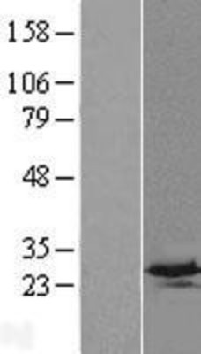 Western Blot: C4orf33 Overexpression Lysate (Adult Normal) [NBP2-09321] Left-Empty vector transfected control cell lysate (HEK293 cell lysate); Right -Over-expression Lysate for C4orf33.