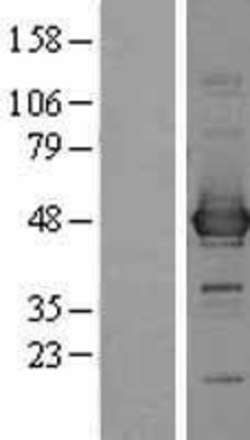 Western Blot: CCBL1 Overexpression Lysate (Adult Normal) [NBP2-09406] Left-Empty vector transfected control cell lysate (HEK293 cell lysate); Right -Over-expression Lysate for CCBL1.