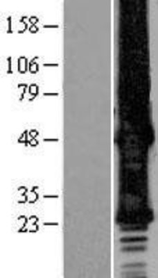 Western Blot: GJB6 Overexpression Lysate (Adult Normal) [NBP2-09371] Left-Empty vector transfected control cell lysate (HEK293 cell lysate); Right -Over-expression Lysate for GJB6.