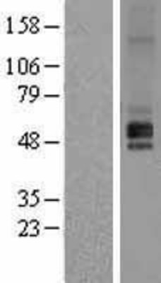 Western Blot: HRH1 Overexpression Lysate (Adult Normal) [NBP2-09294] Left-Empty vector transfected control cell lysate (HEK293 cell lysate); Right -Over-expression Lysate for HRH1.