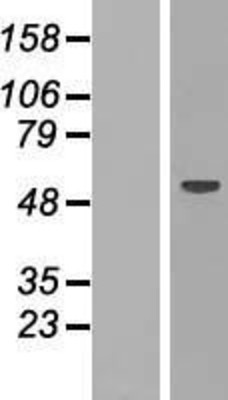Western Blot: RBM47 Overexpression Lysate (Adult Normal) [NBP2-06732] Left-Empty vector transfected control cell lysate (HEK293 cell lysate); Right -Over-expression Lysate for RBM47.