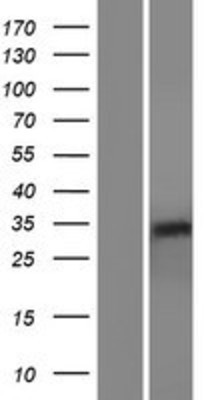 Western Blot: RHBDL2 Overexpression Lysate (Adult Normal) [NBP2-06916] Left-Empty vector transfected control cell lysate (HEK293 cell lysate); Right -Over-expression Lysate for RHBDL2.