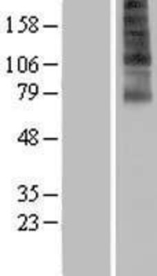 Western Blot: FSCN3 Overexpression Lysate (Adult Normal) [NBP2-06657] Left-Empty vector transfected control cell lysate (HEK293 cell lysate); Right -Over-expression Lysate for FSCN3.