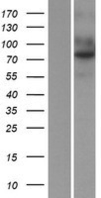 Western Blot: TEM1 Overexpression Lysate (Adult Normal) [NBP2-06637] Left-Empty vector transfected control cell lysate (HEK293 cell lysate); Right -Over-expression Lysate for TEM1.