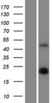 Western Blot: PDGFA Overexpression Lysate (Adult Normal) [NBP2-05931] Left-Empty vector transfected control cell lysate (HEK293 cell lysate); Right -Over-expression Lysate for PDGFA.