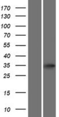 Western Blot: ATOH8 Overexpression Lysate (Adult Normal) [NBP2-05965] Left-Empty vector transfected control cell lysate (HEK293 cell lysate); Right -Over-expression Lysate for ATOH8.