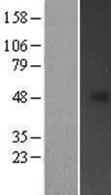 Western Blot: FBXL20 Overexpression Lysate (Adult Normal) [NBP2-05964] Left-Empty vector transfected control cell lysate (HEK293 cell lysate); Right -Over-expression Lysate for FBXL20.