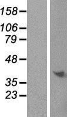 Western Blot: C9orf64 Overexpression Lysate (Adult Normal) [NBP2-06048] Left-Empty vector transfected control cell lysate (HEK293 cell lysate); Right -Over-expression Lysate for C9orf64.