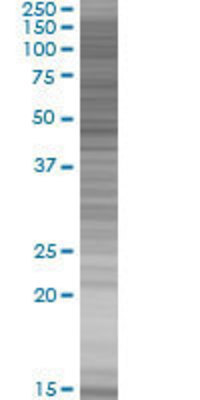 RORB transfected lysate.