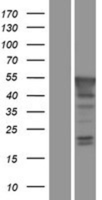 Western Blot: PBX4 Overexpression Lysate (Adult Normal) [NBP2-06218] Left-Empty vector transfected control cell lysate (HEK293 cell lysate); Right -Over-expression Lysate for PBX4.