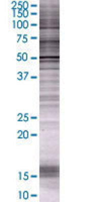 CYP3A5 transfected lysate.