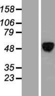 Western Blot: ALX4 Overexpression Lysate (Adult Normal) [NBP2-06508] Left-Empty vector transfected control cell lysate (HEK293 cell lysate); Right -Over-expression Lysate for ALX4.