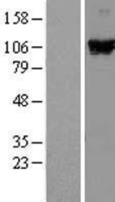 Western Blot: DDX58 Overexpression Lysate (Adult Normal) [NBL1-09808] Left-Empty vector transfected control cell lysate (HEK293 cell lysate); Right -Over-expression Lysate for DDX58.