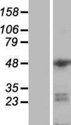 Western Blot: DGCR14 Overexpression Lysate (Adult Normal) [NBP2-06420] Left-Empty vector transfected control cell lysate (HEK293 cell lysate); Right -Over-expression Lysate for DGCR14.