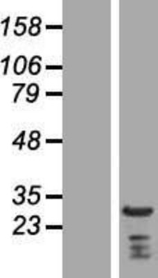 Western Blot: Eaf6 Overexpression Lysate (Adult Normal) [NBP2-06410] Left-Empty vector transfected control cell lysate (HEK293 cell lysate); Right -Over-expression Lysate for Eaf6.