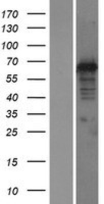Western Blot: DNAJC1 Overexpression Lysate (Adult Normal) [NBP2-06442] Left-Empty vector transfected control cell lysate (HEK293 cell lysate); Right -Over-expression Lysate for DNAJC1.