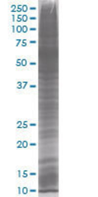 UBE2V2 transfected lysate