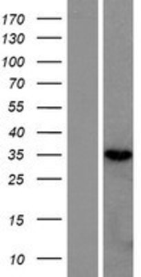 Western Blot: RNASEH2B Overexpression Lysate (Adult Normal) [NBP2-06319] Left-Empty vector transfected control cell lysate (HEK293 cell lysate); Right -Over-expression Lysate for RNASEH2B.