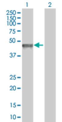 Lane 1: FOXP3 transfected lysate (47.2 KDa). Lane 2: Non-transfected lysate.
