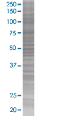 FOXP3 transfected lysate