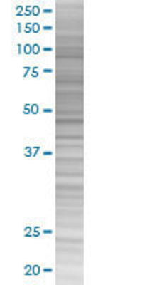 KLK8 transfected lysate.