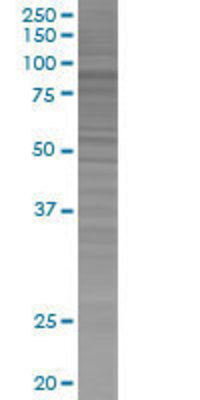RHPN1 transfected lysate.