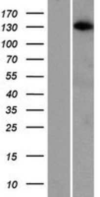 Western Blot: ARHGAP20 Overexpression Lysate (Adult Normal) [NBP2-06602] Left-Empty vector transfected control cell lysate (HEK293 cell lysate); Right -Over-expression Lysate for ARHGAP20.