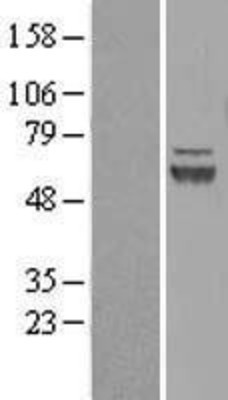 Western Blot: Defensin alpha 5 Overexpression Lysate (Adult Normal) [NBP2-06574] Left-Empty vector transfected control cell lysate (HEK293 cell lysate); Right -Over-expression Lysate for Defensin alpha 5.