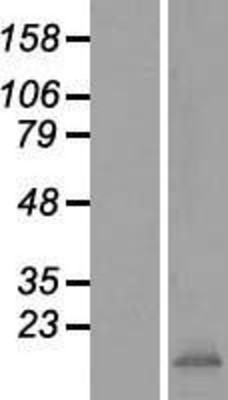 Western Blot: IFITM3 Overexpression Lysate (Adult Normal) [NBP2-06569] Left-Empty vector transfected control cell lysate (HEK293 cell lysate); Right -Over-expression Lysate for IFITM3.