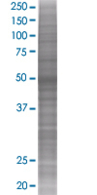 CFLAR transfected lysate.