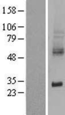 Western Blot: xCT Overexpression Lysate (Adult Normal) [NBL1-16185] Left-Empty vector transfected control cell lysate (HEK293 cell lysate); Right -Over-expression Lysate for xCT.